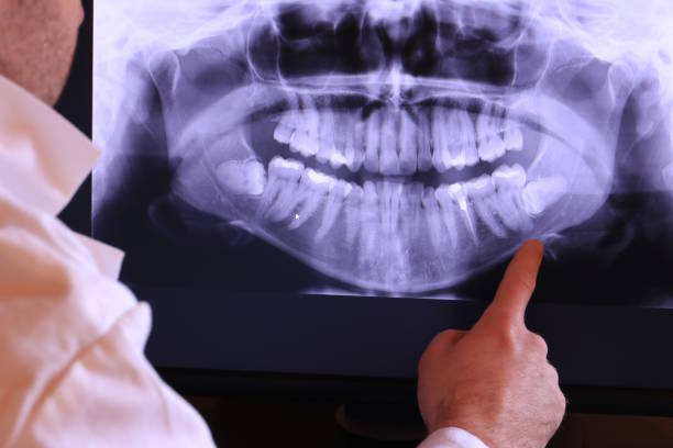 Best Emergency TMJ Treatment in Madill, OK