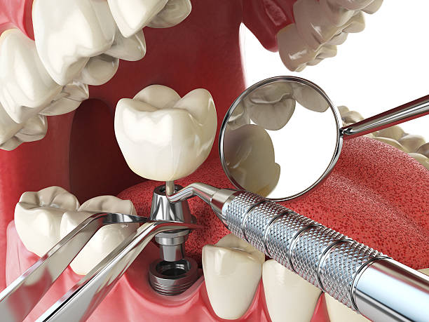 Best Cosmetic Emergency Dentistry in Madill, OK